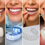 What Are the Best Cosmetic Dentistry Options for Your Smile?
